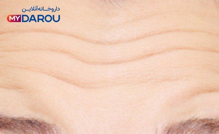 کرم ضد چروک بالای 50 سال